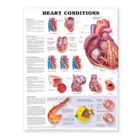 Heart Conditions, 20" x 26", Laminated