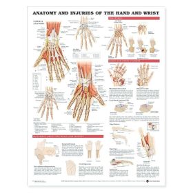 Anatomy&Injuries Hand & Wrist, Laminated